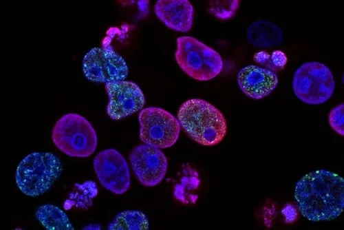 How to Read an HPLC Mass Spectrometry Report
